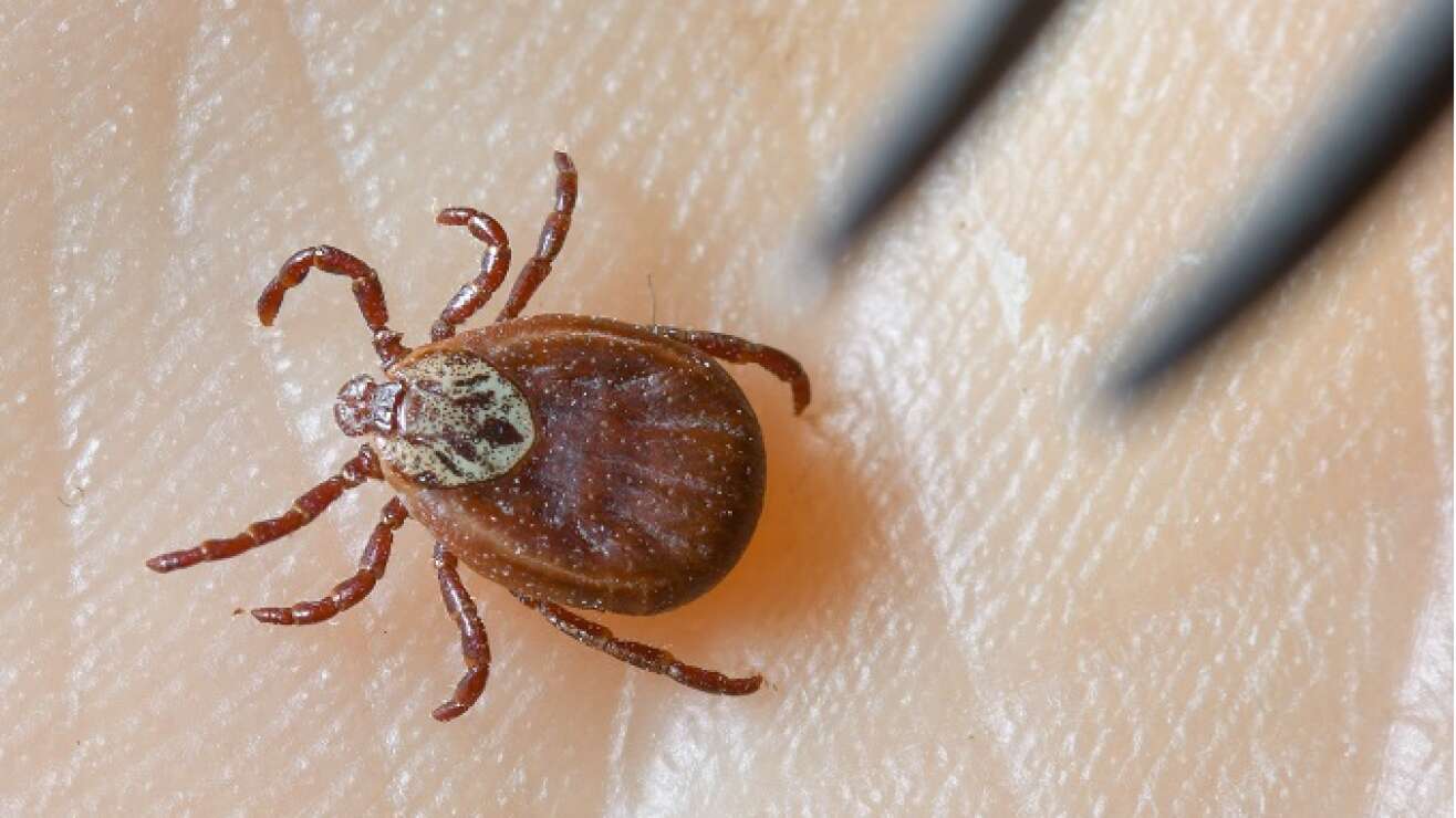 Zecken entfernen: Darauf solltet ihr unbedingt achten